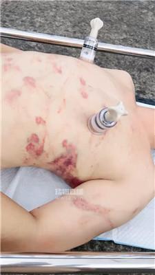 黛樱 户外阳台重刑调-螃蟹夹乳 bf56757_HD绳艺资源