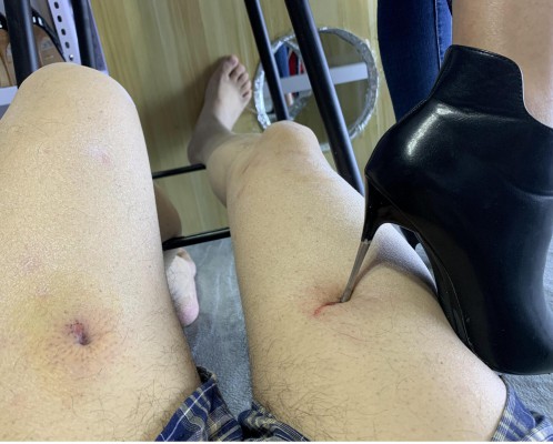 超细打磨的鞋跟大腿钻血洞,10和12厘米高跟跺肚子 YC-211012-3